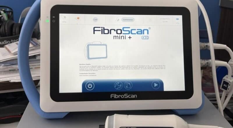 FibroScan