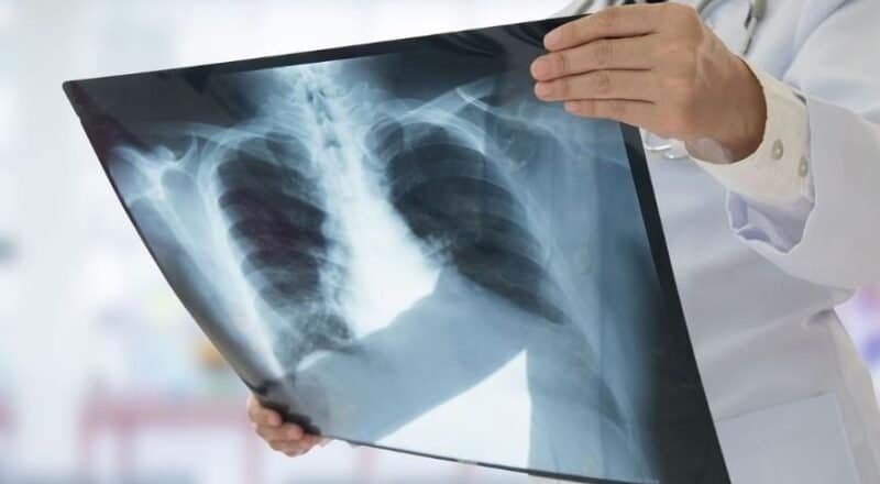 guérir d’un sarcome